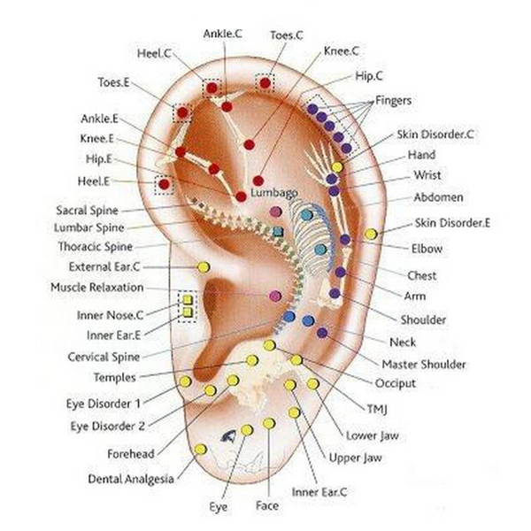 acupuncture-oreille