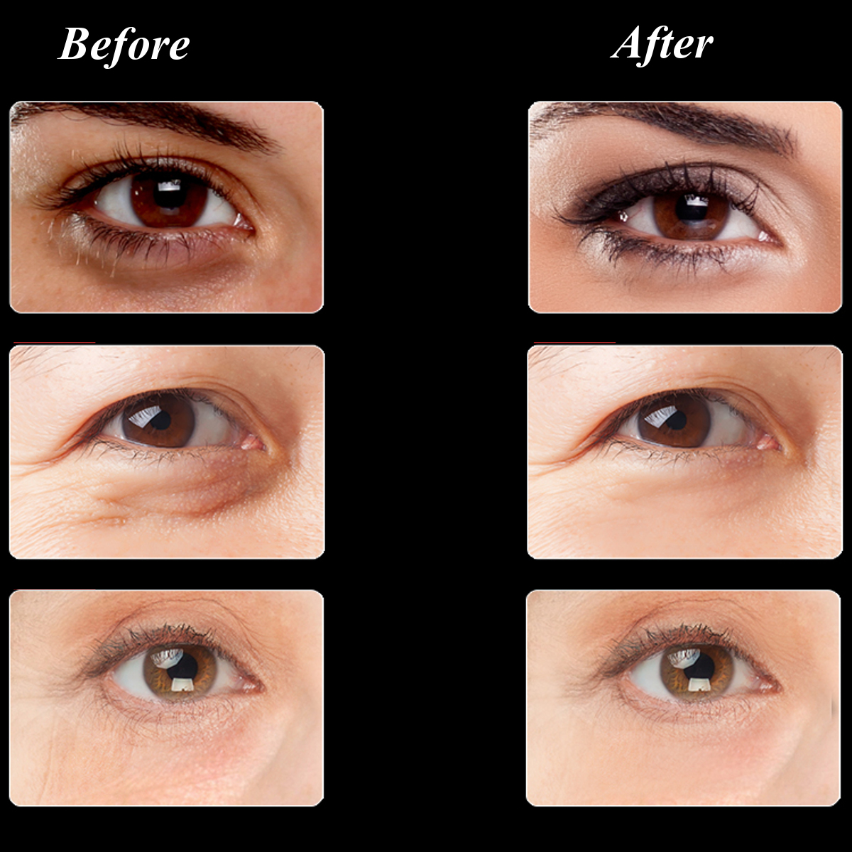 Mabox Eye Gel Cream Anti-Wrinkles Remove Dark Circle Lighten