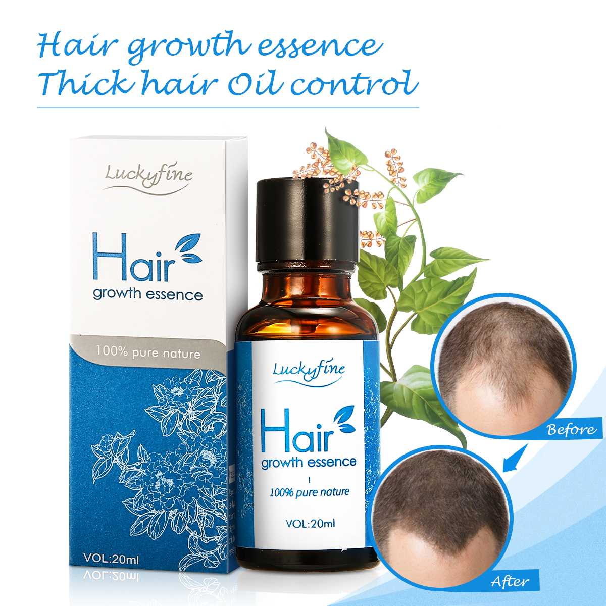 Hair Growth Essence Oil Anti Hair Loss Nutrition Hair Root Inmprove Hair  Thick Shiny Hair Care 20ml