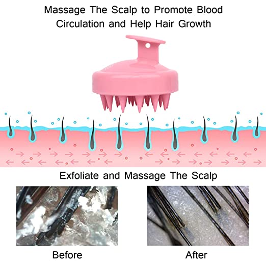 Hair Scalp Massager Shampoo Brush Head Scalp Massage Brush Remove Dandruff Promote Hair Growth Shampoo Brush