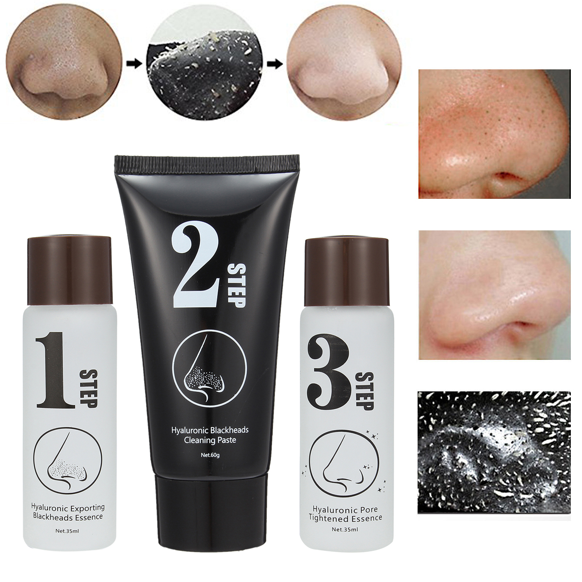 Luckyfine 3 Steps Blackhead Removal Face Nose Mask Blackhead Acne Removal Activated Carbon Set