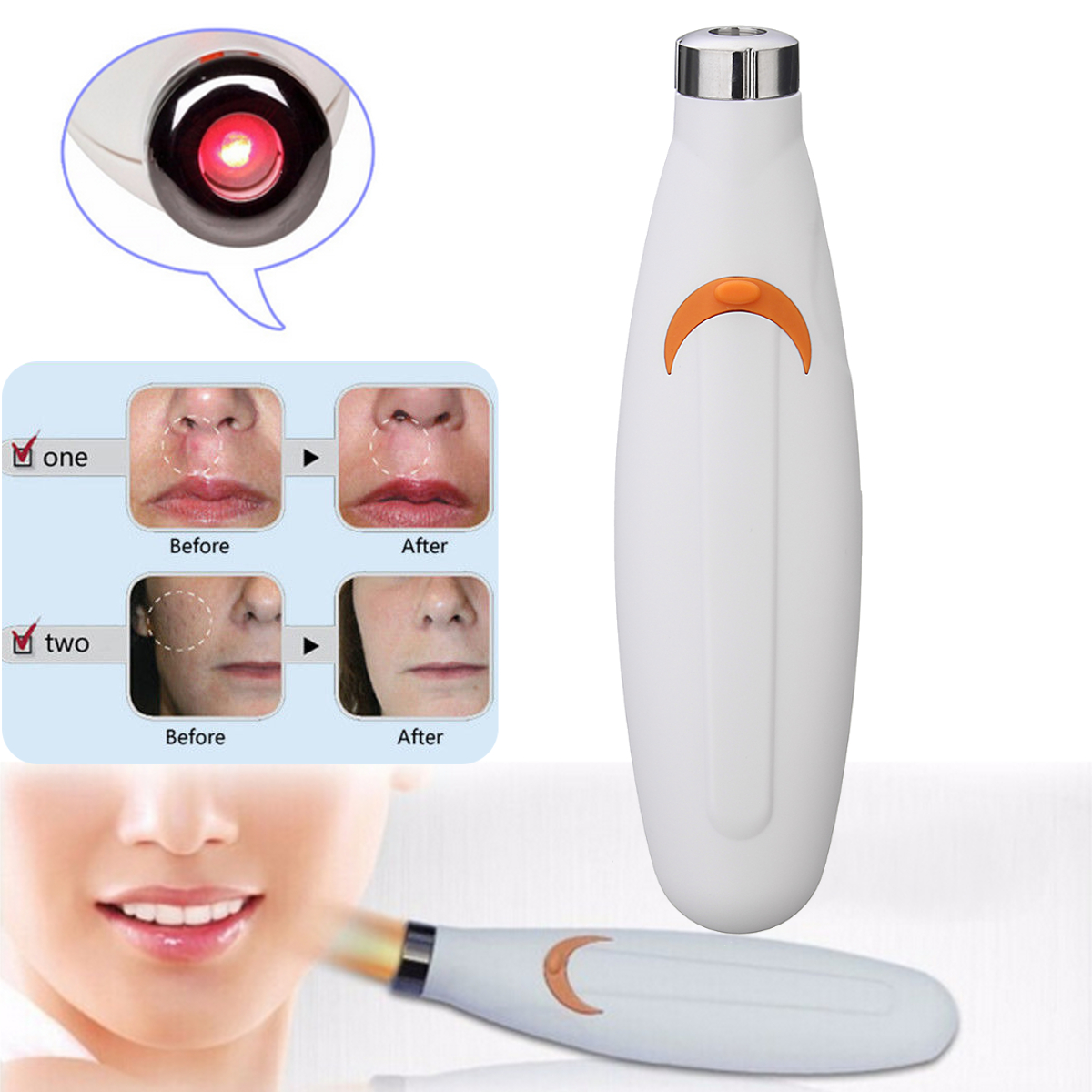 Laser Therapy Machine Acne Pen Soft Scar Blemish Wrinkle Removal Light Treatment Beauty Tool