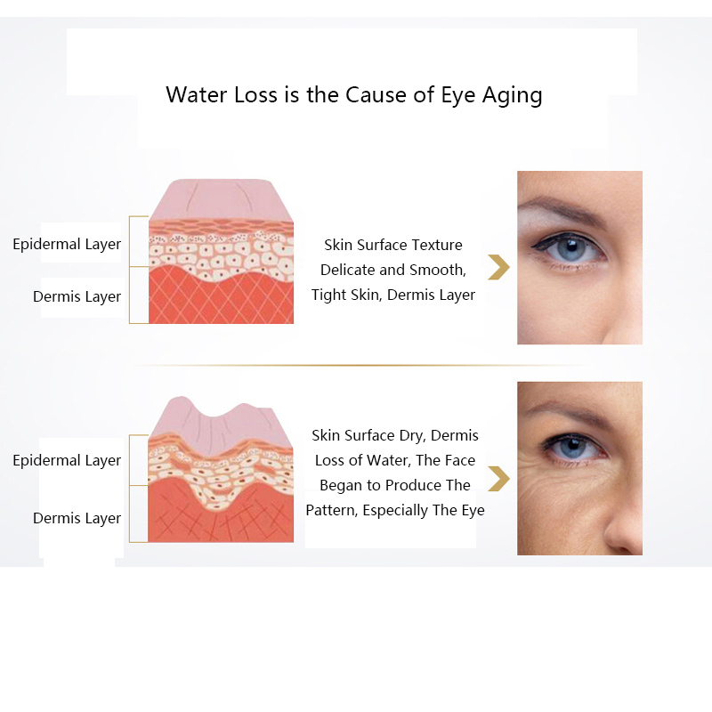 Eye Essence Hyaluronic Acid Cream Anti Aging Wrinkle Remove Dark Circles Moisturizing