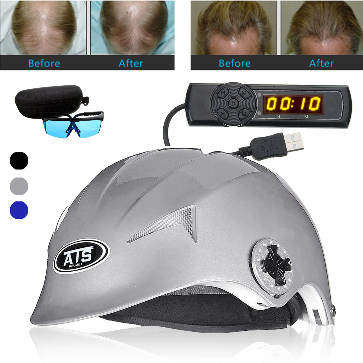 64 Medical Diodes Laser Hair Loss Treatment Solution Helmet Cap Fast Regrowth Oil Control Glasses