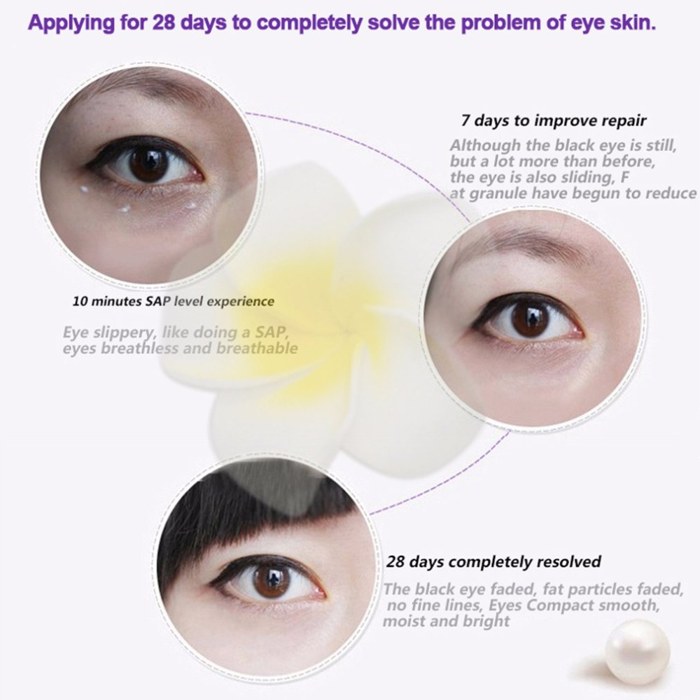 MeiYanQiong Eye Essence Roller Pouch Remover Anti Aging Eyes Skin Care