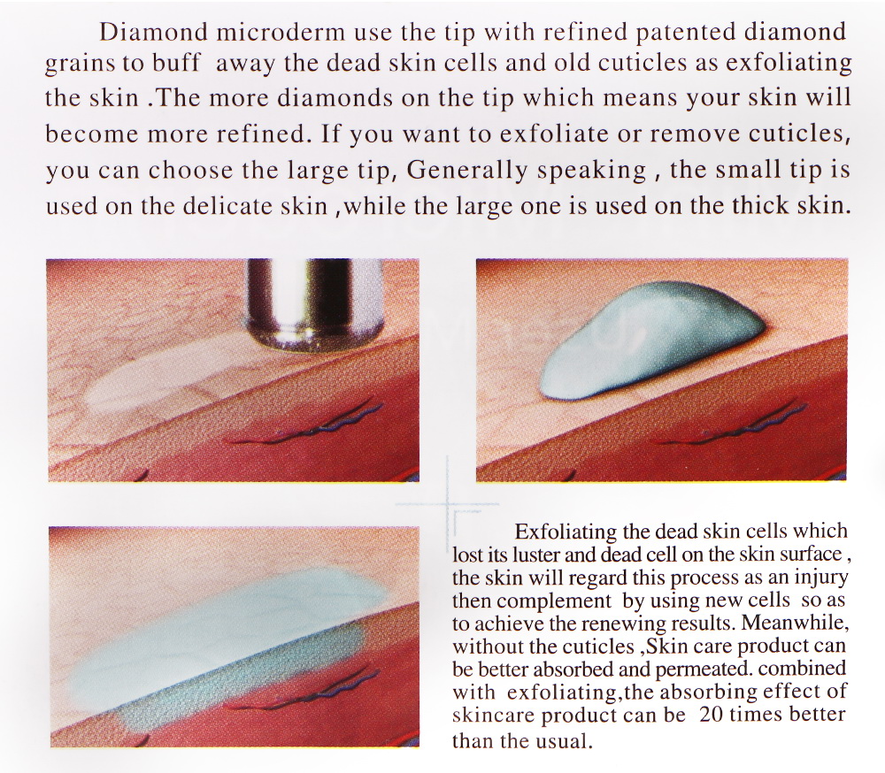 Portable Diamond Micro-crystal Dermabrasion Machine