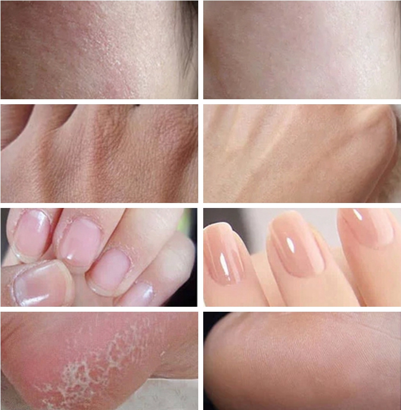 Vaseline Ointment Anti-cracking Cream Nourishing Moisturizing Hydrating Elastic Hand Foot Skin Care