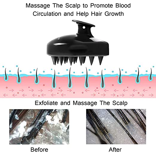Hair Scalp Massager Shampoo Brush Head Scalp Massage Brush Remove Dandruff Promote Hair Growth Shampoo Brush