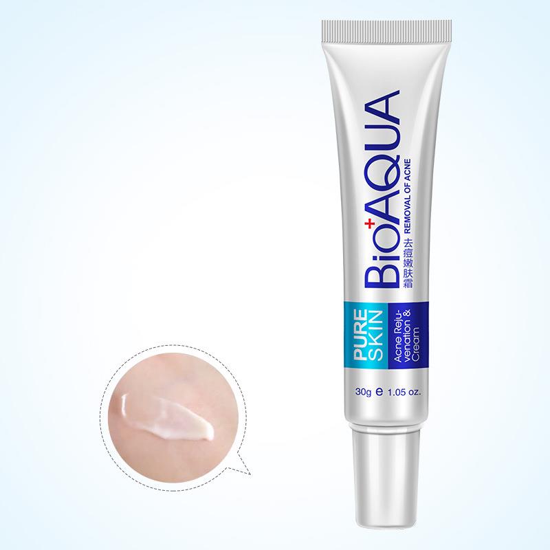 BIOAQUA Anti Acne Scar Mark Remover Removal Oil Control Shrink Pores Treatment Cream 