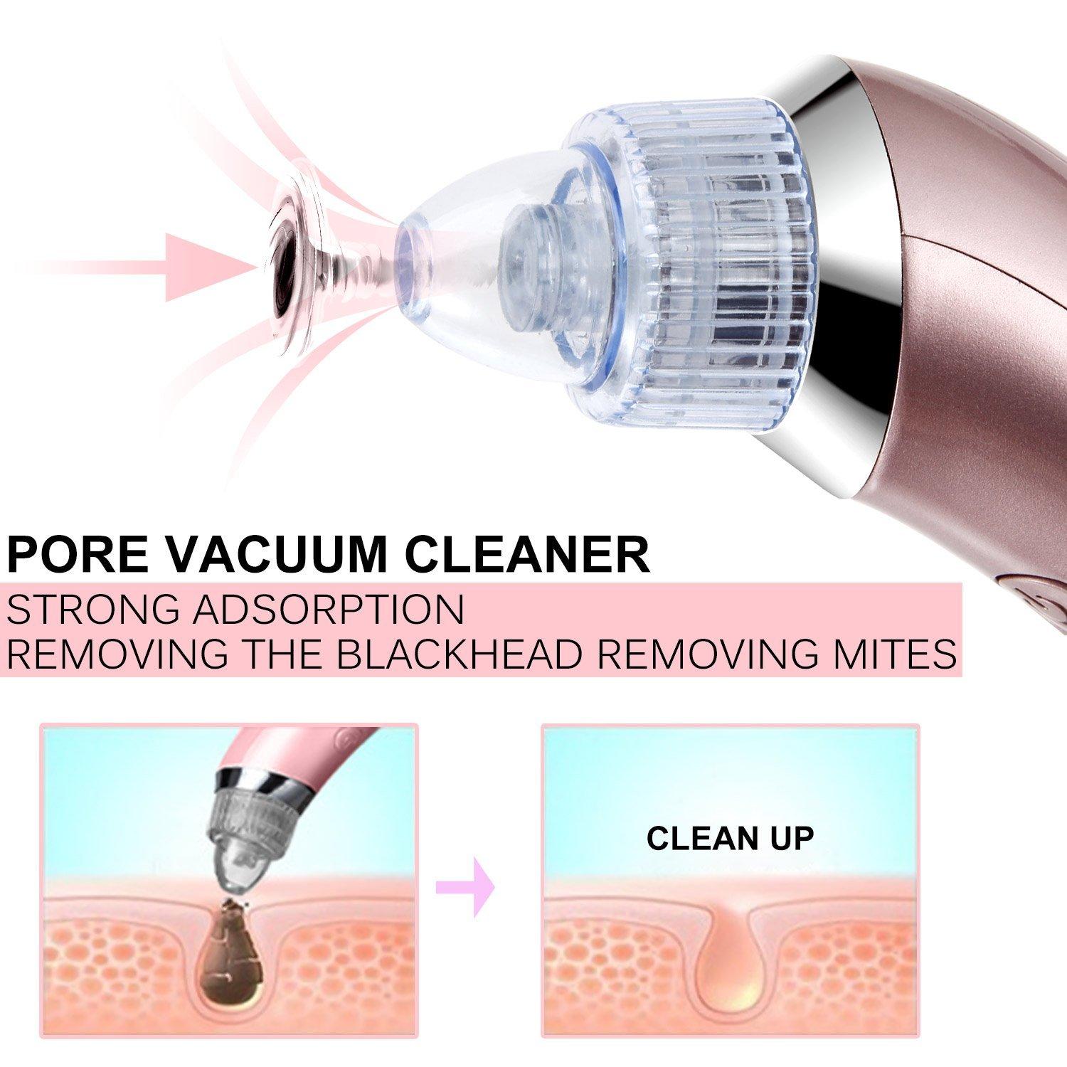 Electric Blackhead Suction Tool Ance Remover Pore Cleanser Vacuum Microdermabrasion Facial Skin Lift