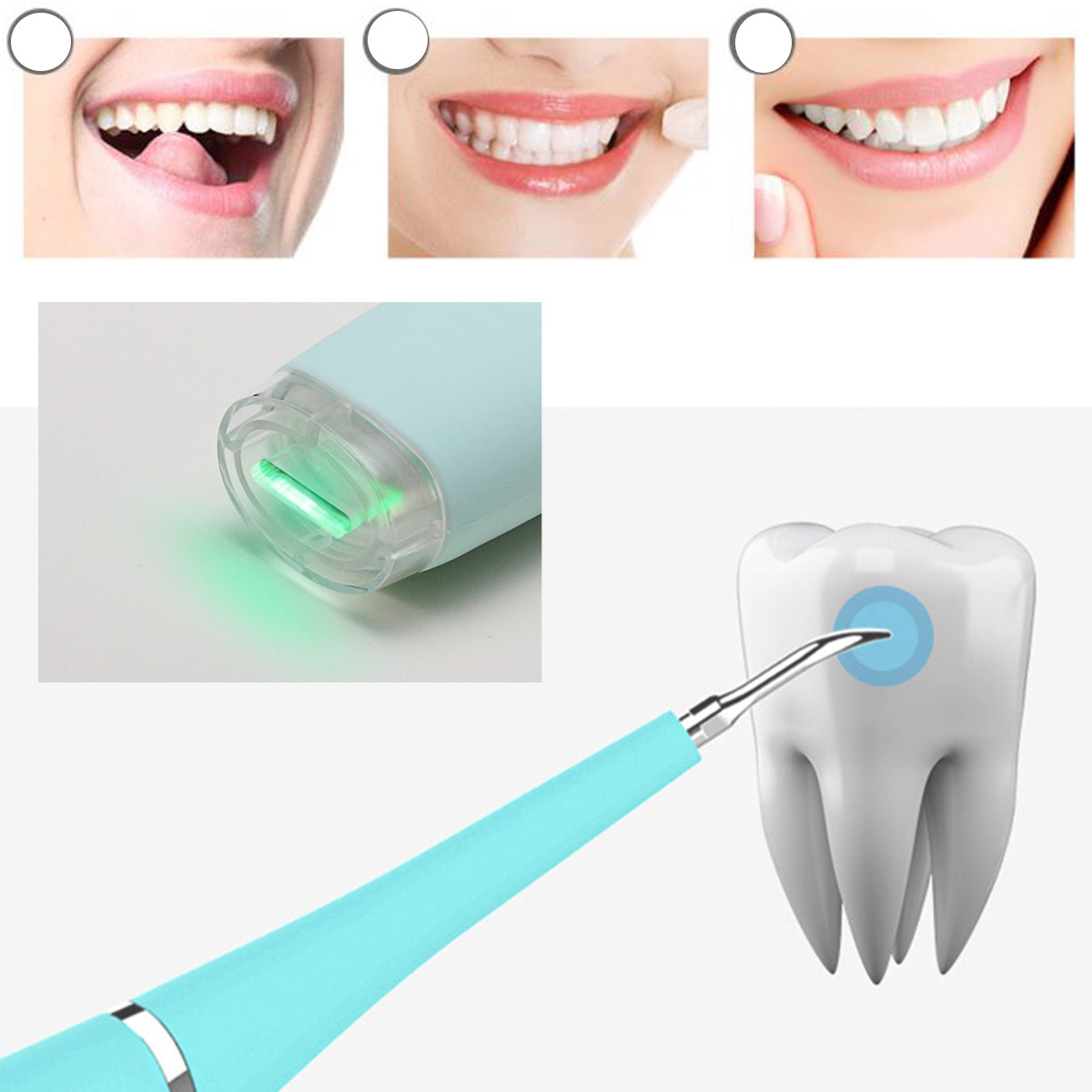 Как называется инструмент для чистки зубов ультразвуком. Прибор для снятия зуба. Приспособление для зубной нити. Прибор для снятия камней с зубов у стоматолога.