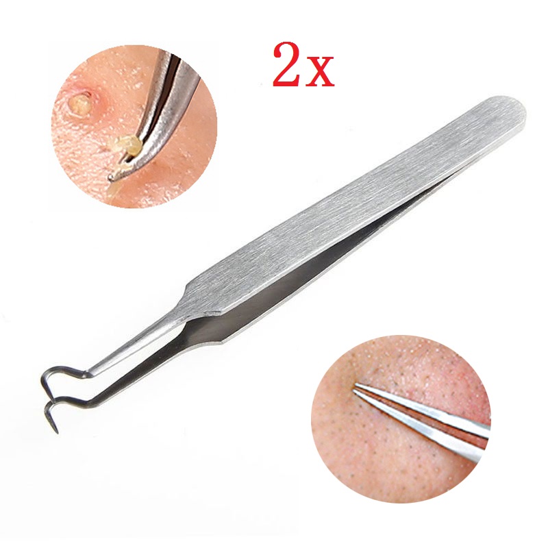 Y.F.M 2Pcs Stainless Steel Remover Blackhead Comedone Acne Blemish Nipper Beauty Tools