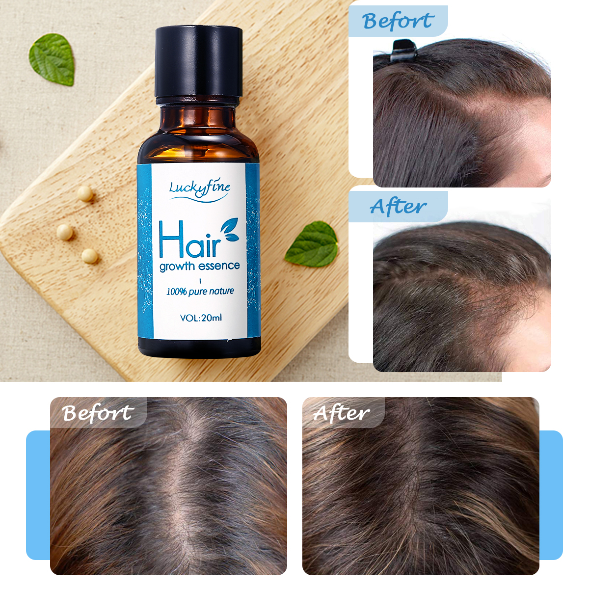 Hair Growth Essence Oil Anti Hair Loss Nutrition Hair Root Inmprove Hair  Thick Shiny Hair Care 20ml