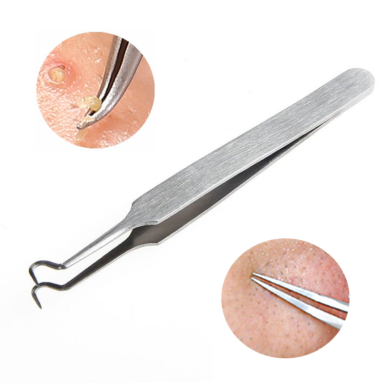 Y.F.M Stainless Steel Remover Blackhead Comedone Acne Blemish Nipper Beauty Tools