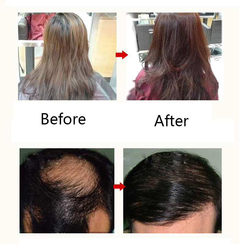 250ml Hair Loss Care Shampoos Growth Natural Herb Effective Solution Hair Thinning Breakage