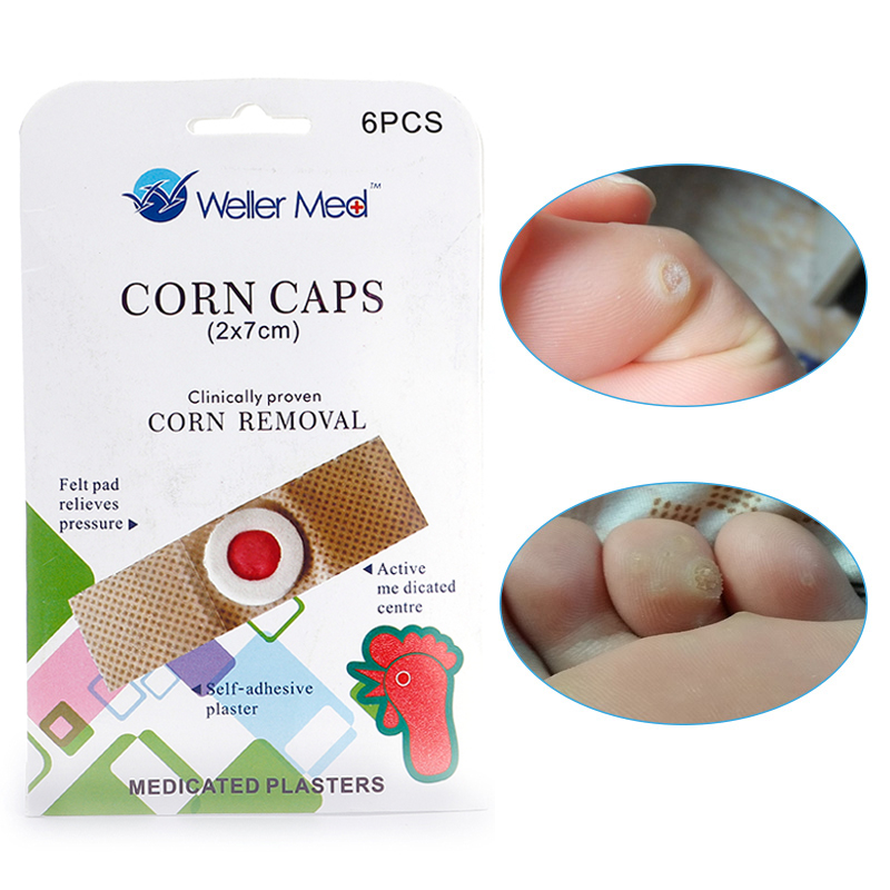 30pcs Foot Care Medical Plaster Foot Corn Removal